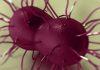 Massachusetts health officials announce first cases of ‘concerning’ new gonorrhea strain – Boston 25 News Massachusetts health officials announce first cases of ‘concerning’ new gonorrhea strain – Boston 25 News